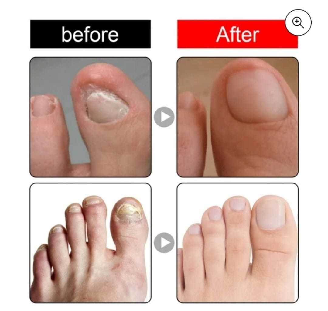 Miniatura 4 de ACEITE REPARADOR DE UÑAS